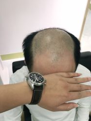 -发饰美男士增发补发假发定制店