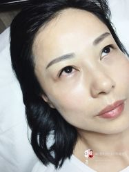 点击看大图 -西施无菌半永久纹绣眉眼影唇轻增发纹发际线