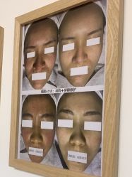 -美肤盾祛痘·问题肌头疗管理中心