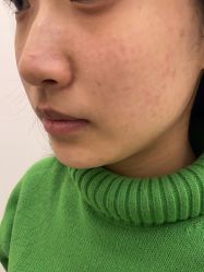 -BR光电保养