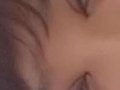 第二天-上海华安整形外科门诊部