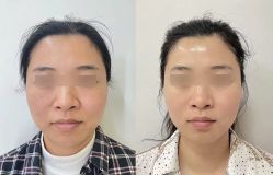 -安吉拉青春化管理中心