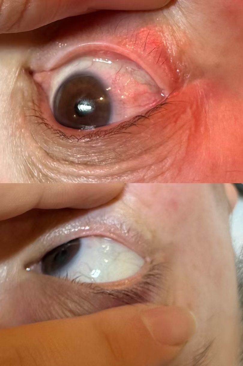 晚上顾客做完眼睛👁前后对比,顾客说做完
