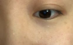 -深圳春天阳光医院·轮廓抗衰中心