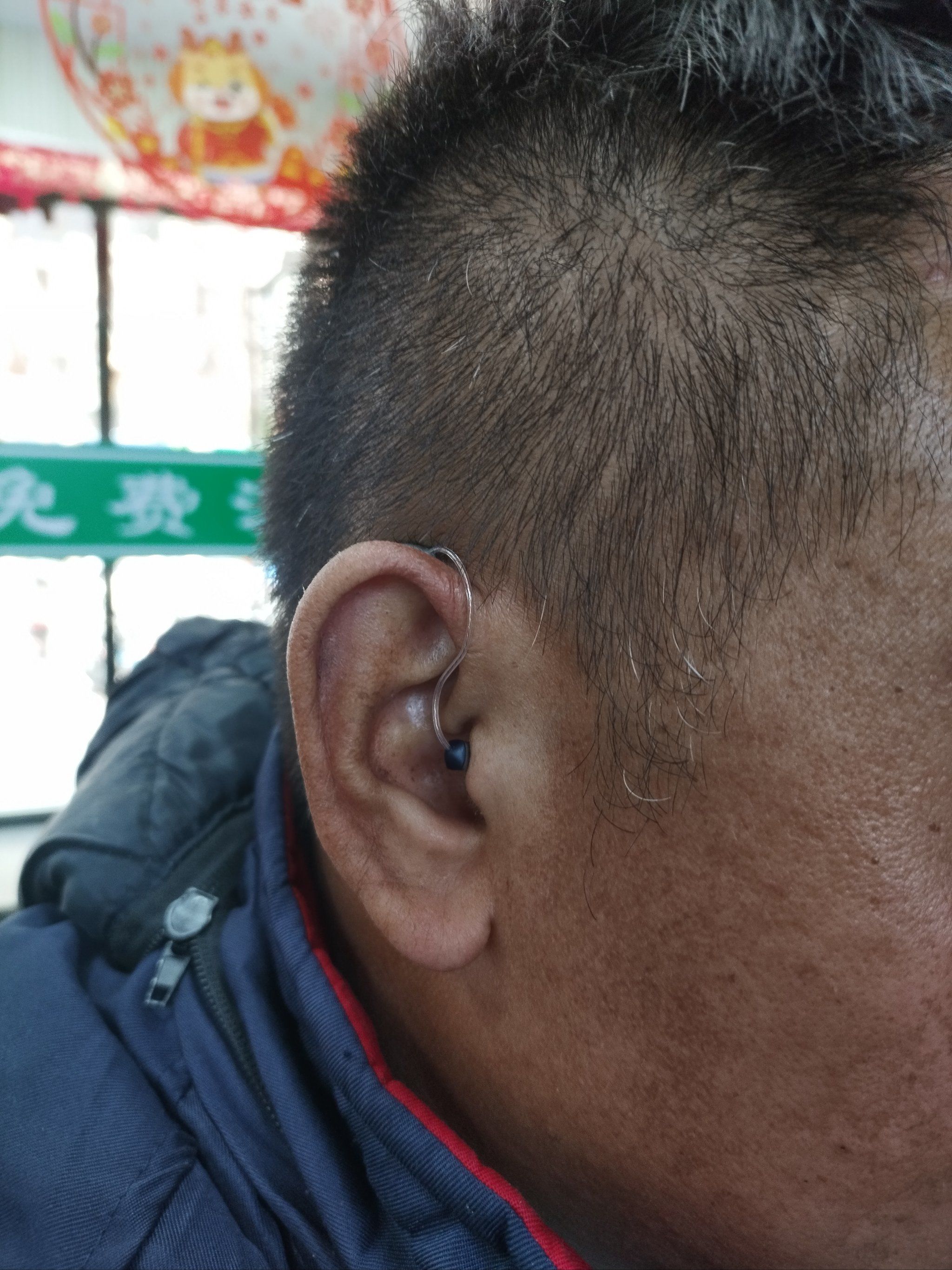 老年性耳聋有两大特点,一是两个耳朵都发病