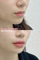 -深圳艺星医疗美容医院