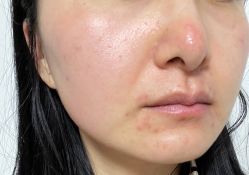 体验后-上海玫瑰医疗美容医院