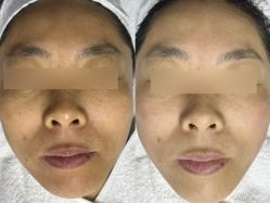 -E.beauty驻颜·痘敏肌调理中心