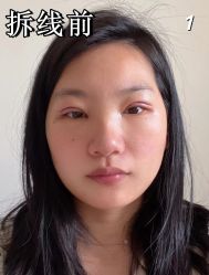 -素美医疗美容·西南眼鼻整形·修复基地