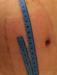 -肥三针腧穴瘦身馆