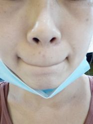 点击看大图 体验后-上海宏康医院·医疗美容科