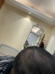 -碧莲盛·不剃发植发