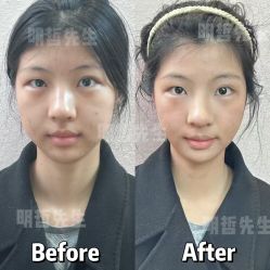 -颜和骨正·明哲式骨相美学整骨
