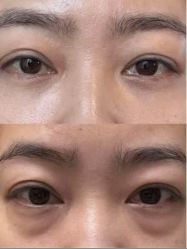 -紫洁俪方（北京）医疗美容