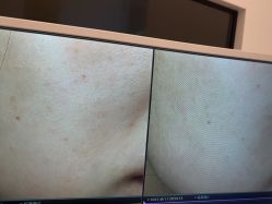 -苑苑vbeauty科技美容SPA