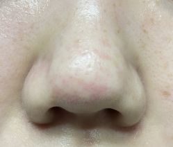 -SKIN79皮肤管理中心