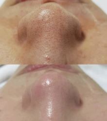 -SKIN79皮肤管理中心