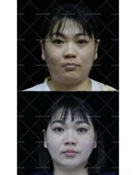 -洁铭新加坡医美