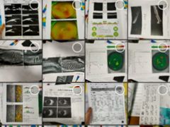 -上海大学附属上海和平眼科医院