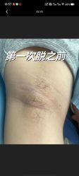 体验前-广州粤秀医疗美容医院