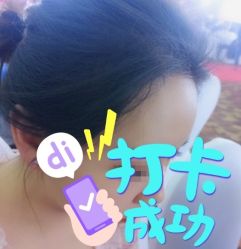 -大麦微针植发全国连锁