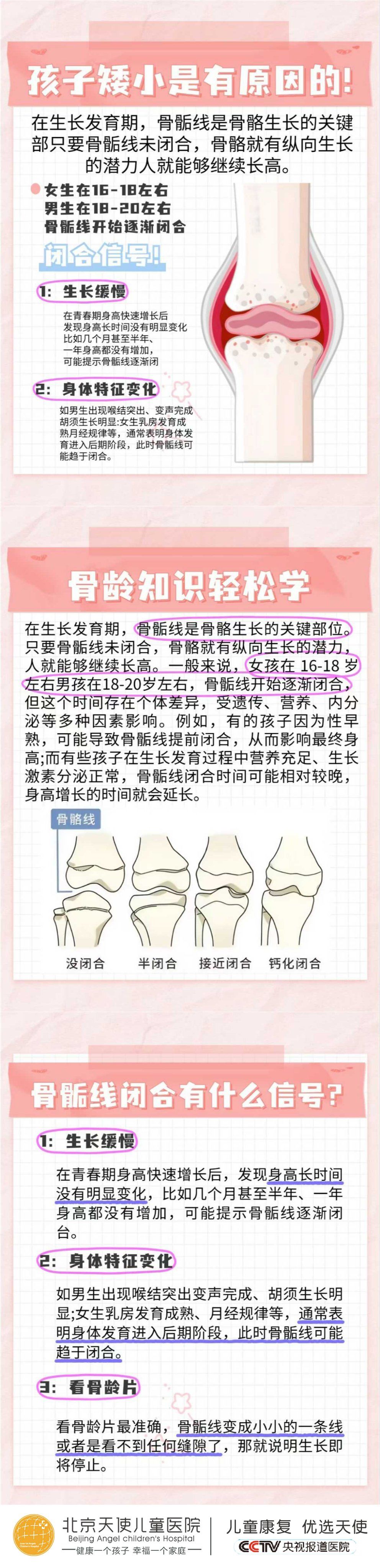 骨骺线