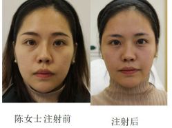 -丰联丽格医疗美容·联合丽格眼整形中心