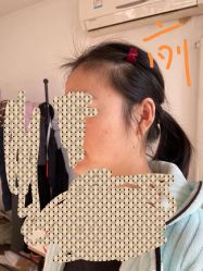 体验前-小忠丽格医美