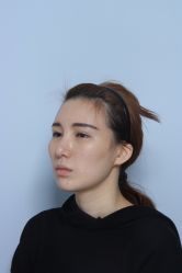 -大华韩艺整形美容医院