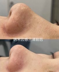 -SKIN79皮肤管理中心