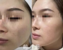 -KONSISTANT科思坦汀问题肌·科技美肤