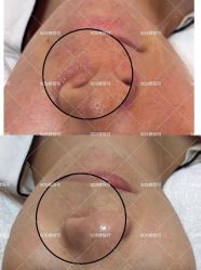 -SOS修丽可.痘肌修复中心