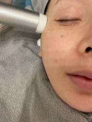 体验前-杭州医巢医疗美容