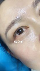 点击看大图 体验前-重庆联合丽格第五医疗美容医院