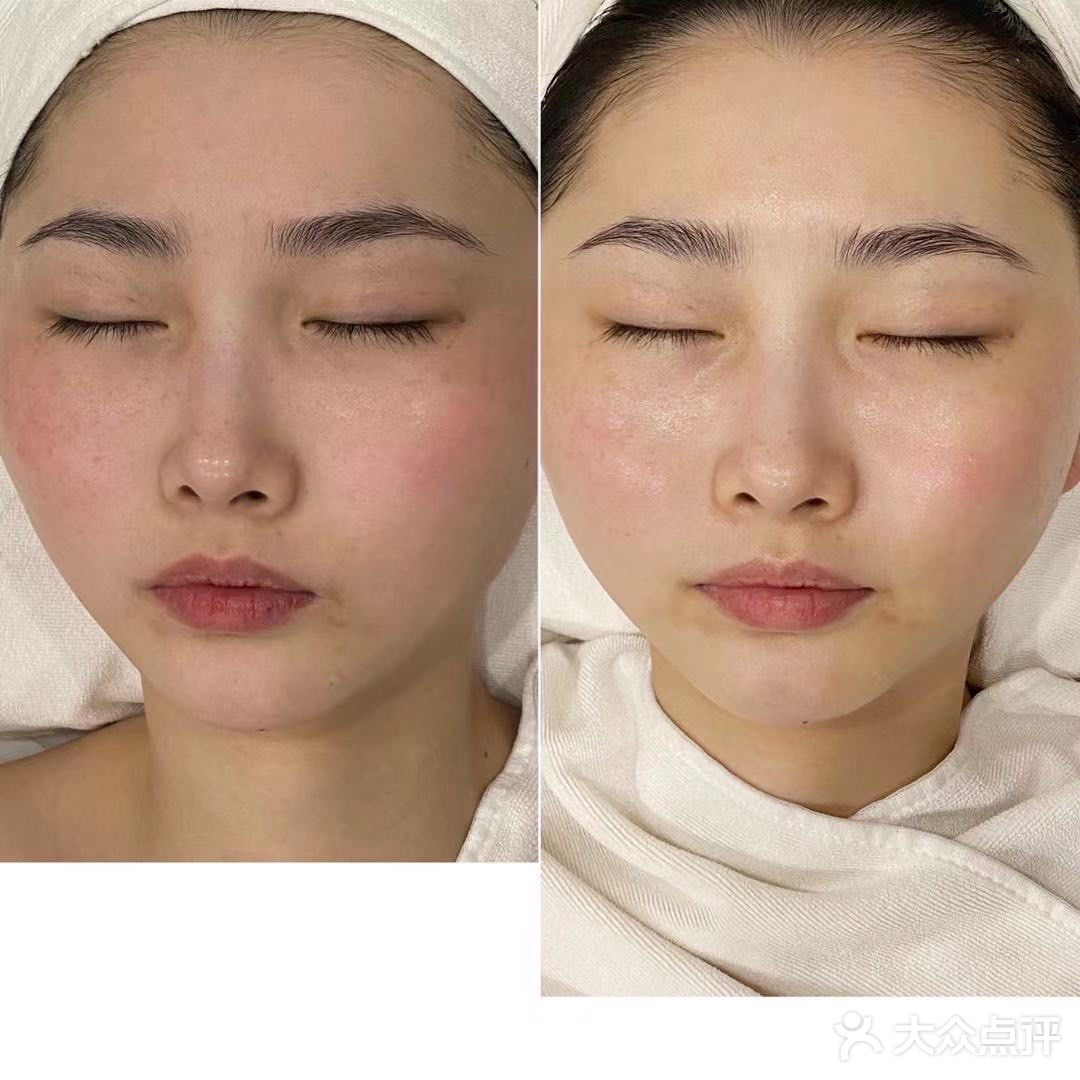 极简护肤|给脸部做一次SPA