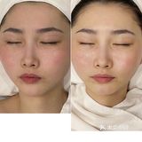 极简护肤|给脸部做一次SPA