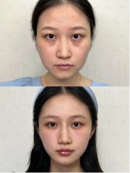 -南京美莱医疗美容·旗舰店