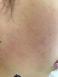 -蕾特恩专业祛痘·皮肤管理