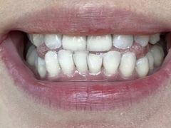 -Dr.Z dental仁康种植矫正中心