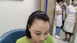 -大麦微针植发全国连锁