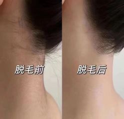 点击看大图 -玫莉蔻皮肤管理中心
