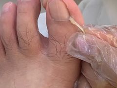 -新甲连锁灰指甲·甲沟炎·鸡眼(黑龙江路店)