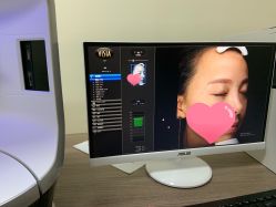 -丽美妍医疗美容·皮秒·立体分层抗衰