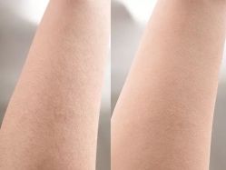 -薇兰专业脱毛连锁机构