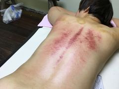 -沈师傅盲人按摩工作室(密三小区店)