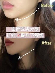 -上海漾颜医疗美容