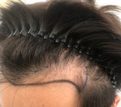 -熙朵美学植发·连锁品牌