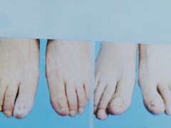 -世龙世家手足健康护理连锁(福田梅林路润裕花园店)