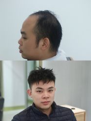 -发饰美男士增发补发假发定制店