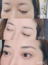 -西施无菌半永久纹绣眉眼影唇轻增发纹发际线